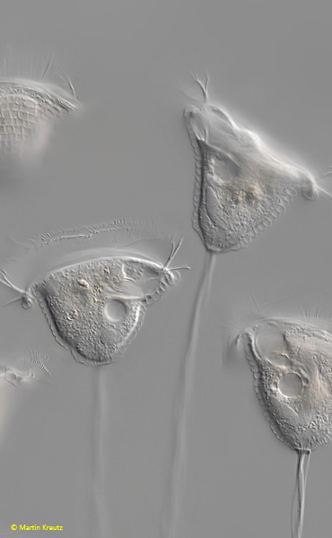 Pseudovorticella-chlamydophora