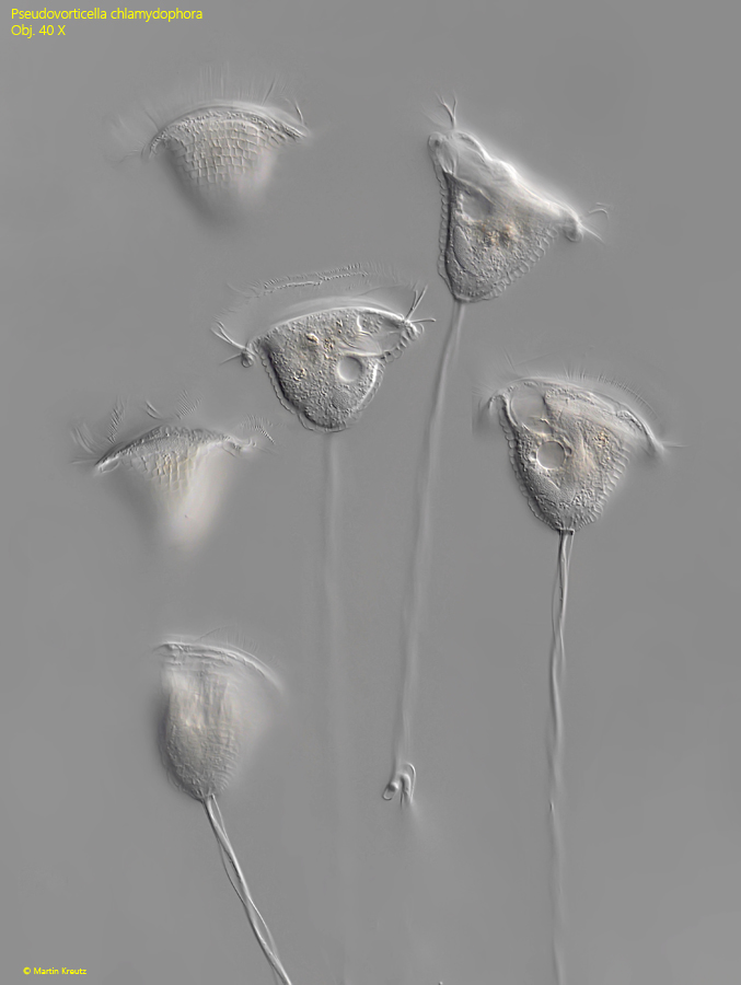 Pseudovorticella-chlamydophora