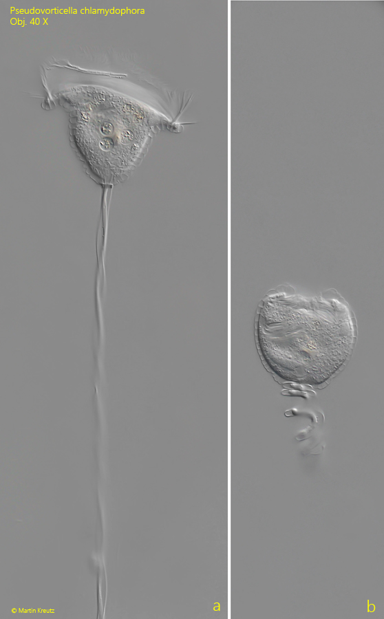 Pseudovorticella-chlamydophora