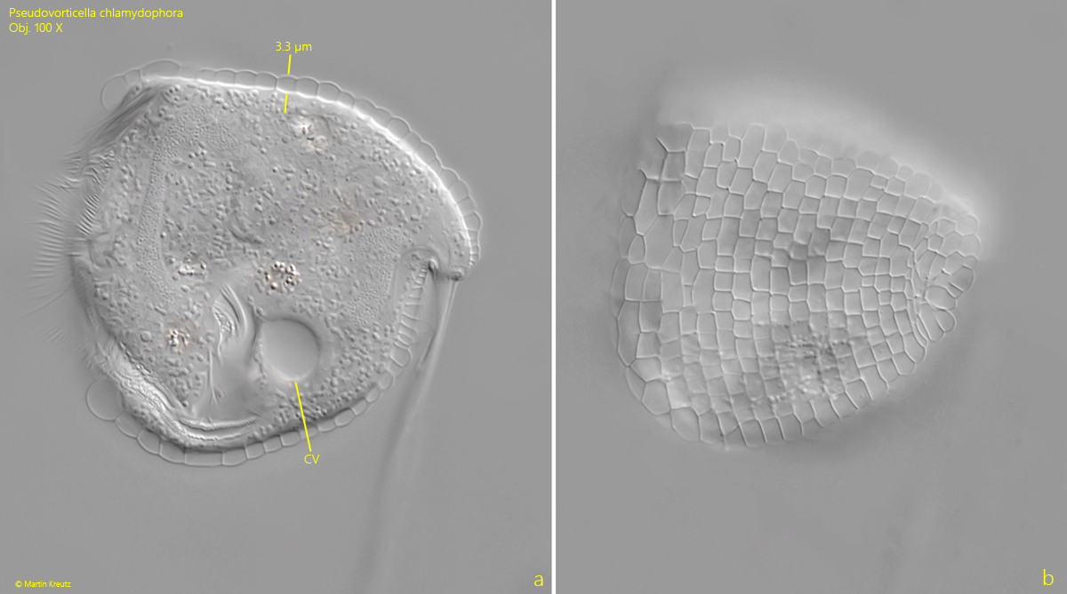 Pseudovorticella-chlamydophora
