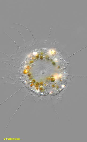 Raphidiophrys-ovalis